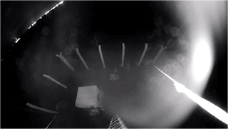 2 ir image without IR Anti-reflection Panel